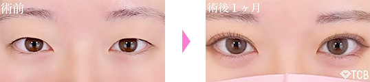 症例実績